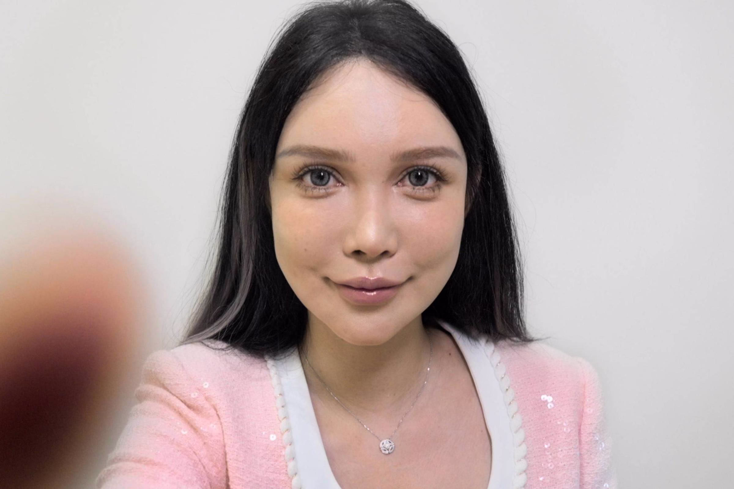 Cirurgias Plásticas Na China: 'Fiz 100 Operações' - 25/04/2025 - Equilíbrio