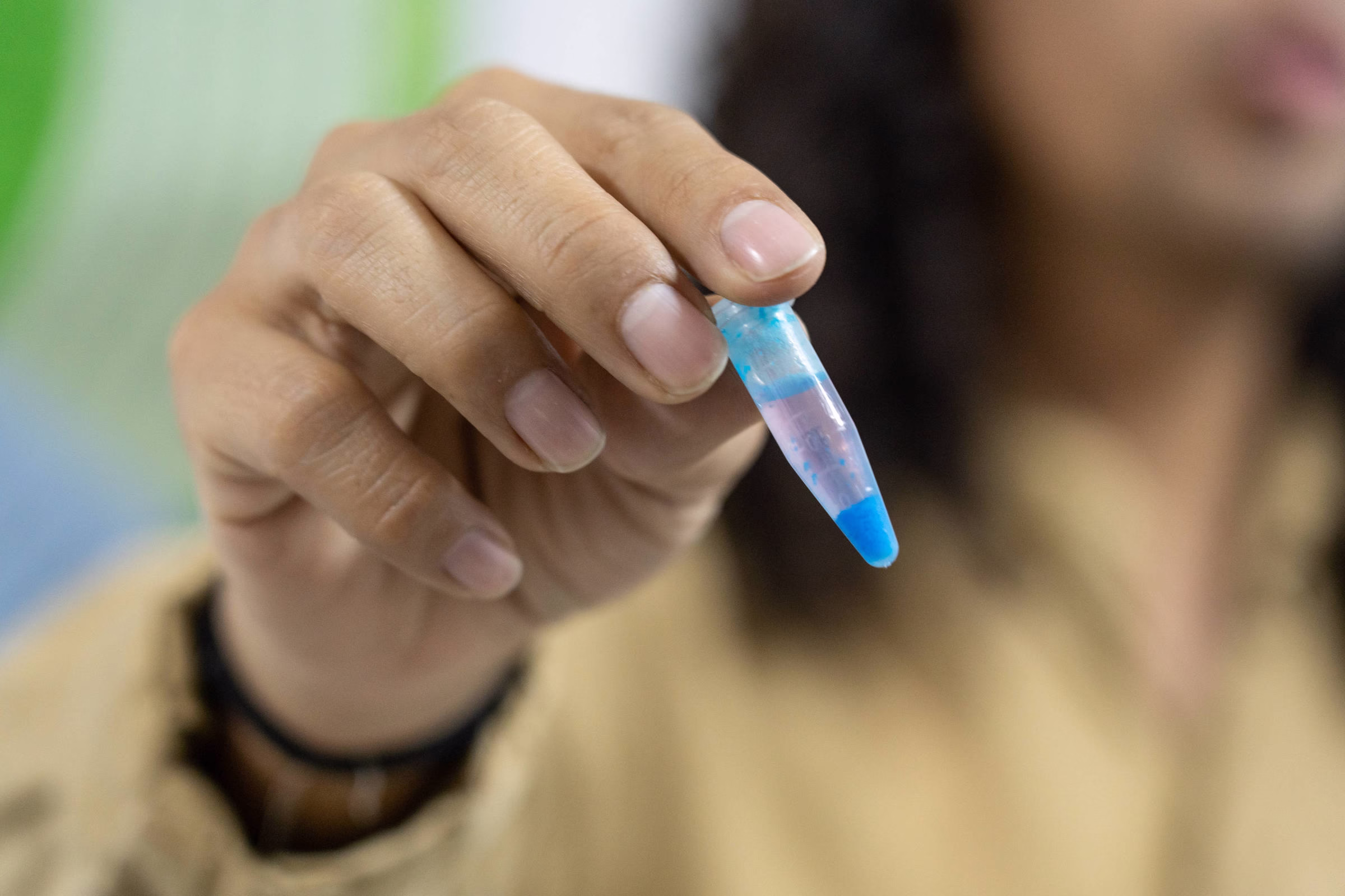 Em Bogotá, Usuários De Drogas Têm Sala Para Uso Seguro - 29/04/2025 - Equilíbrio E Saúde