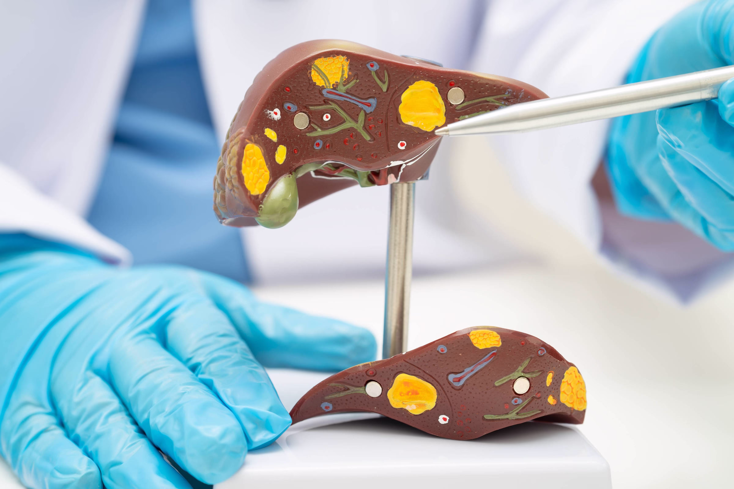 Datafolha: Gordura No Fígado Preocupa 62% Dos Brasileiros - 19/05/2025 - Equilíbrio E Saúde