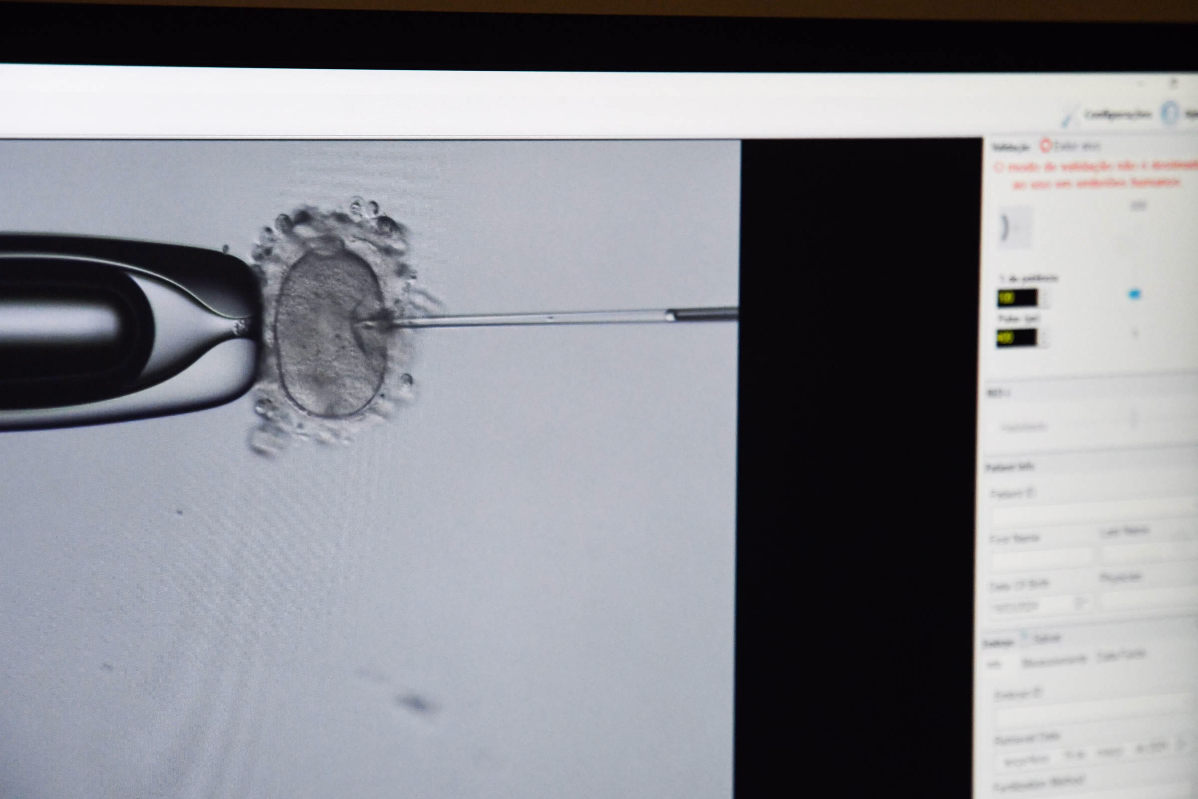 Justiça Determina Que Plano Custeie Congelamento De Óvulos - 26/05/2025 - Equilíbrio E Saúde