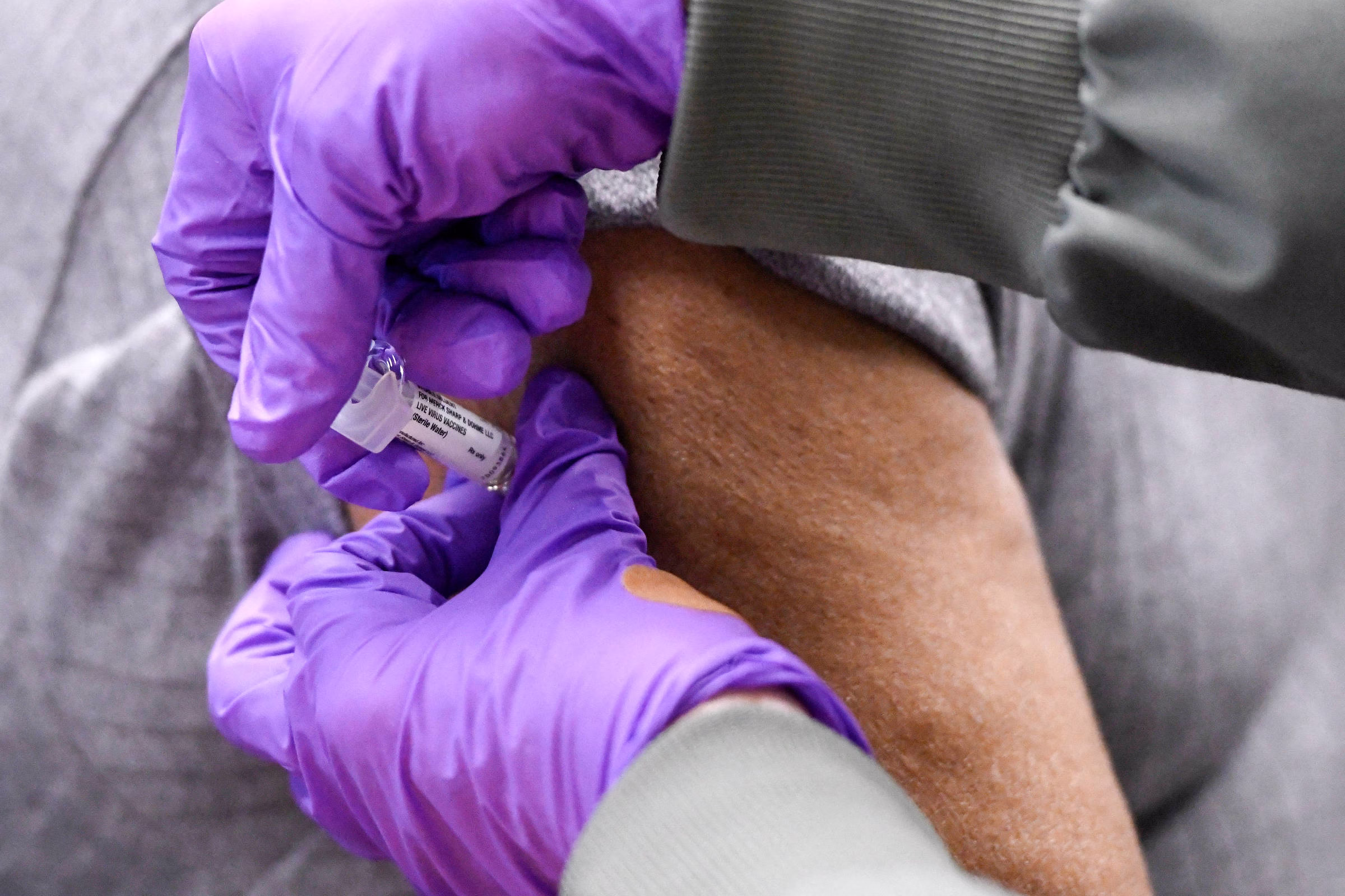 Surto De Sarampo Nos Eua Supera Mil Casos Confirmados - 10/05/2025 - Equilíbrio E Saúde