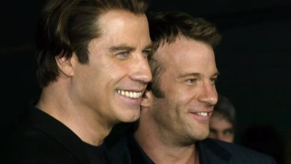 Lembra Deles Com Cabelo? Esses Famosos Mudaram O Visual Radicalmente