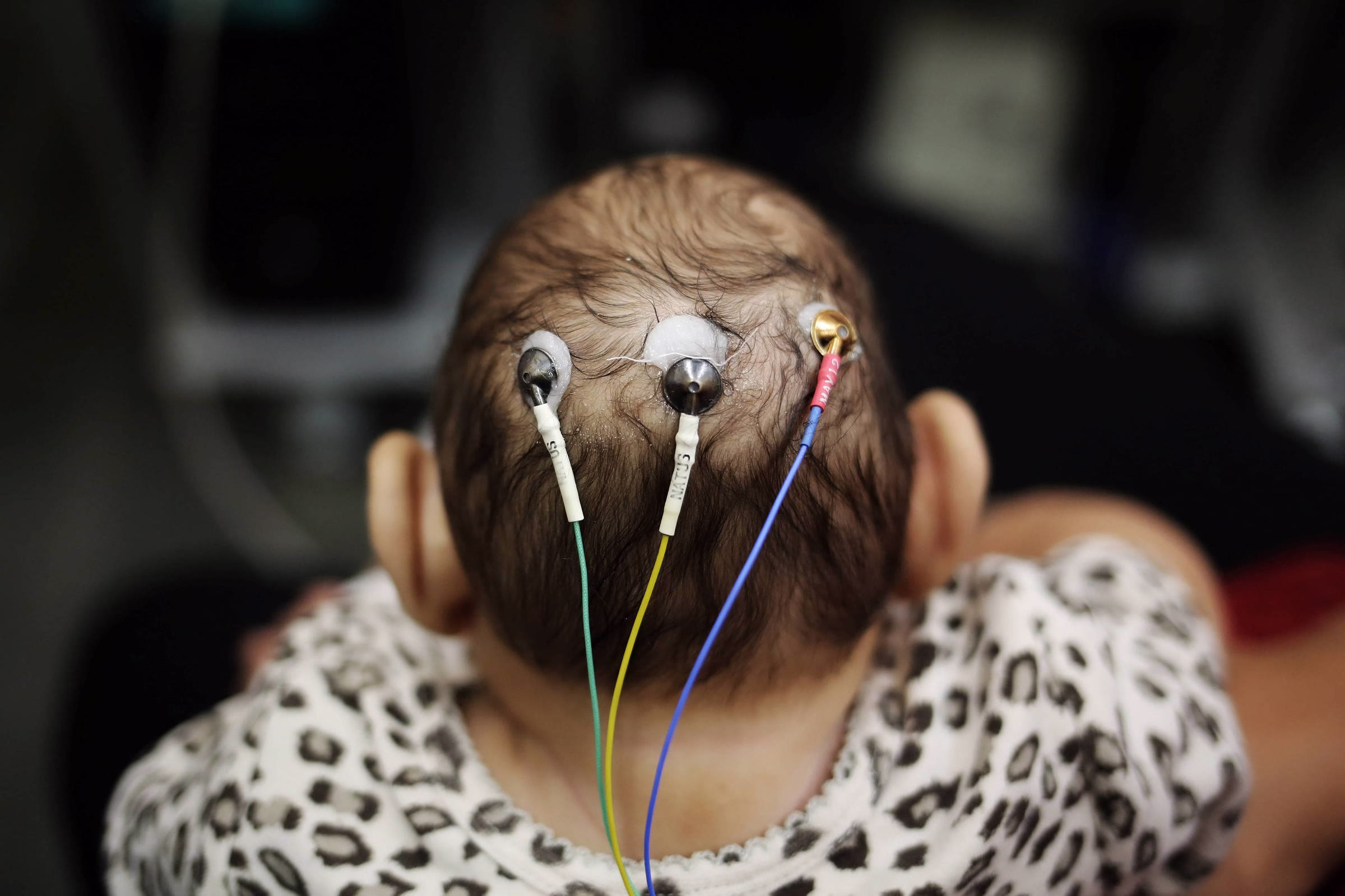 Dino Autoriza Governo Pagar Pensão A Vítimas Do Vírus Zika - 11/08/2025 - Equilíbrio E Saúde