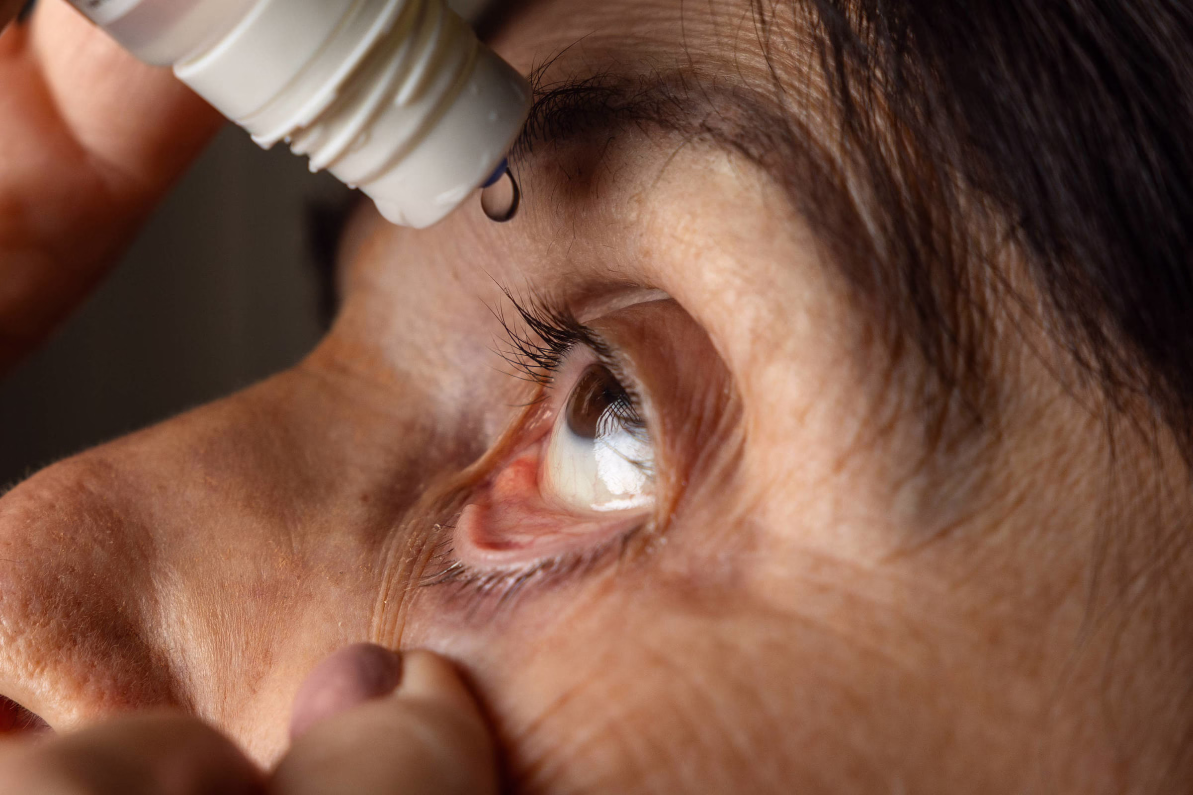 Fda Aprova Colírio Que Substitui Óculos Por Até 10 Horas - 20/08/2025 - Equilíbrio E Saúde