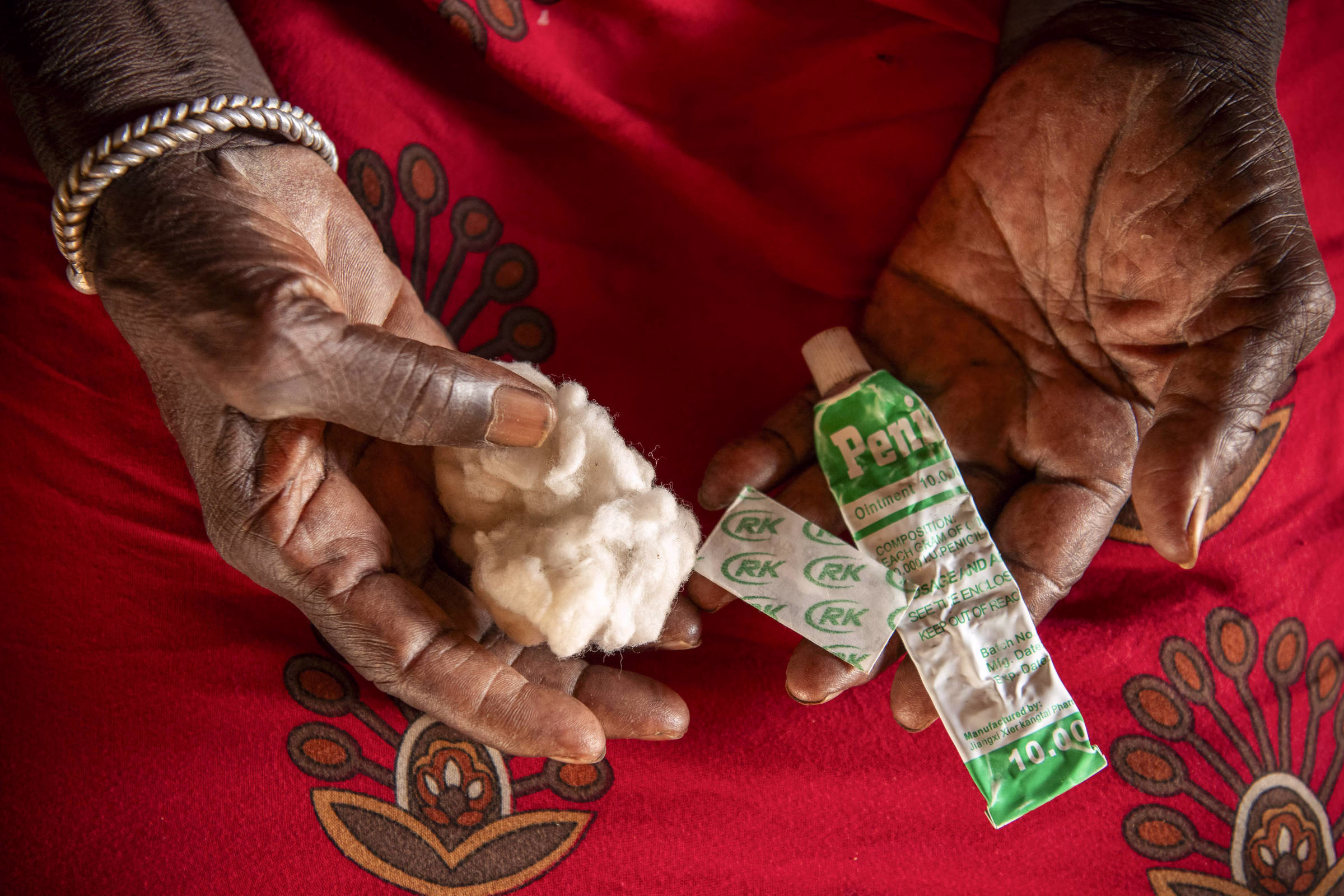 Morte De Bebê Na Gâmbia Reabre Debate Sobre Mutilação - 12/08/2025 - Equilíbrio E Saúde