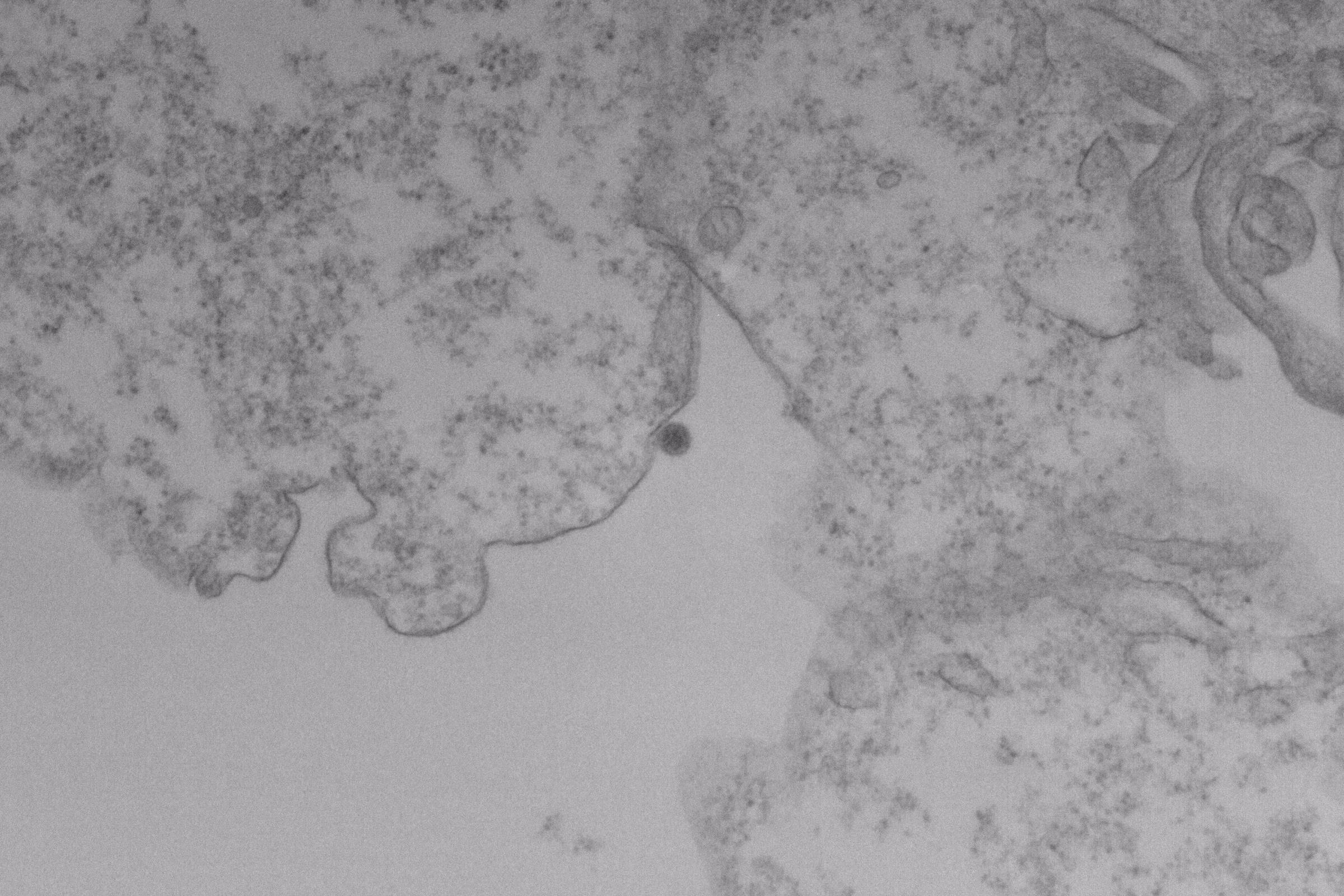 Vírus Oropouche É Registrado Infectando Células - 21/08/2025 - Ciência