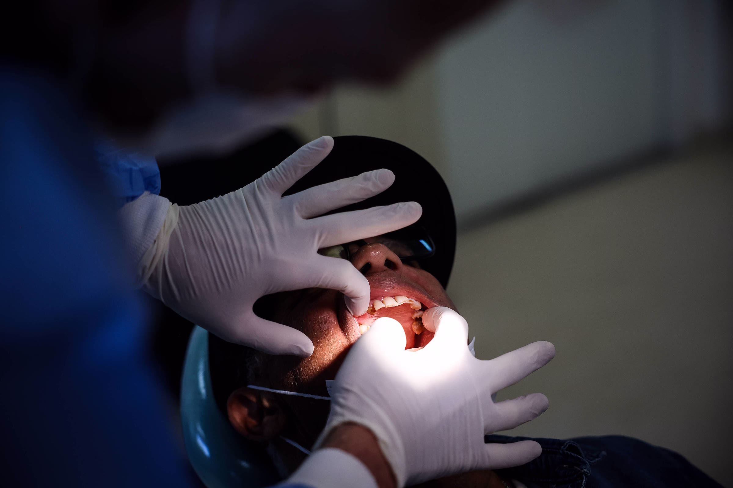 Bactérias Na Boca Aumentam Risco De Câncer De Pâncreas - 22/09/2025 - Equilíbrio E Saúde