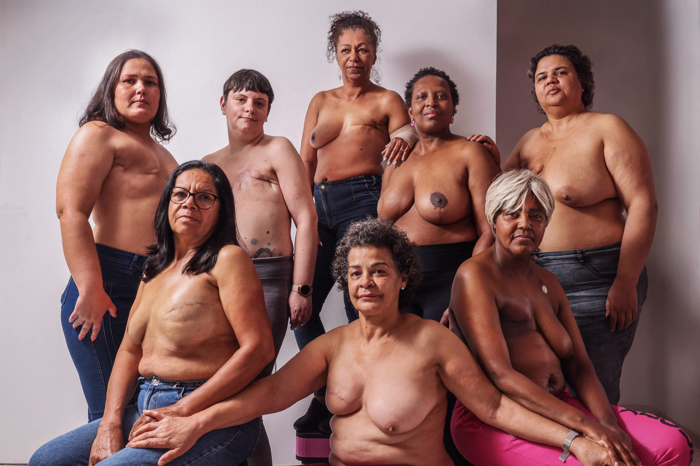 Projeto Atende De Graça Mulheres Que Fizeram Mastectomia - 13/09/2025 - Equilíbrio E Saúde